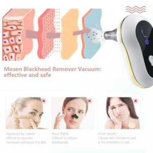 Mini mitesszer eltávolító készülék - vákuumos pórustisztító 5 cserélhető fejjel - 1,6 W (BBV) - Image 6