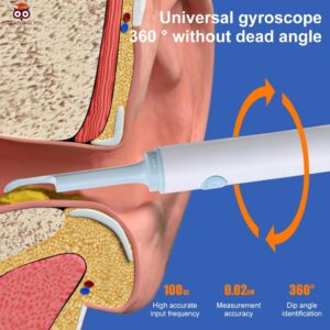 Vezeték nélküli endoszkópos fültisztító készülék - WiFi-s otoszkóp cserélhető szilikon fejekkel (THM) (BBD) - Image 9