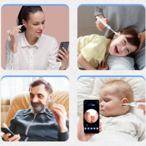 Vezeték nélküli endoszkópos fültisztító készülék - WiFi-s otoszkóp cserélhető szilikon fejekkel (THM) (BBD) - Image 7