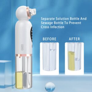 KH-8825 mini vapozon - professzionális kozmetikai pórustisztító készülék - gőzölős mitesszer eltávolító (BBV) - Image 4