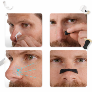 AirFlow Pro orrtágító készlet – horkolás ellen és orrdugulásra, alváshoz és sporthoz (BBM) - Image 6